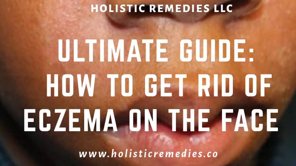 Ultimate Guide: How to Get Rid of Eczema on the Face [Infographic]