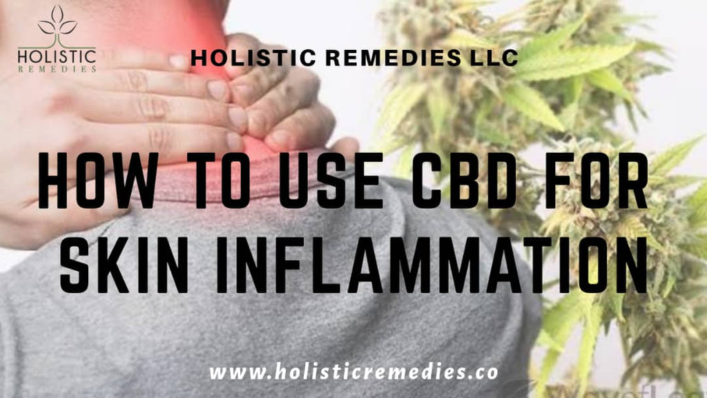 How to Use CBD for Skin Inflammation