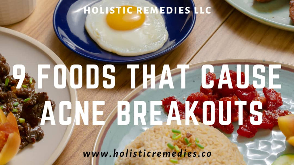 9 Foods That Cause Acne Breakouts