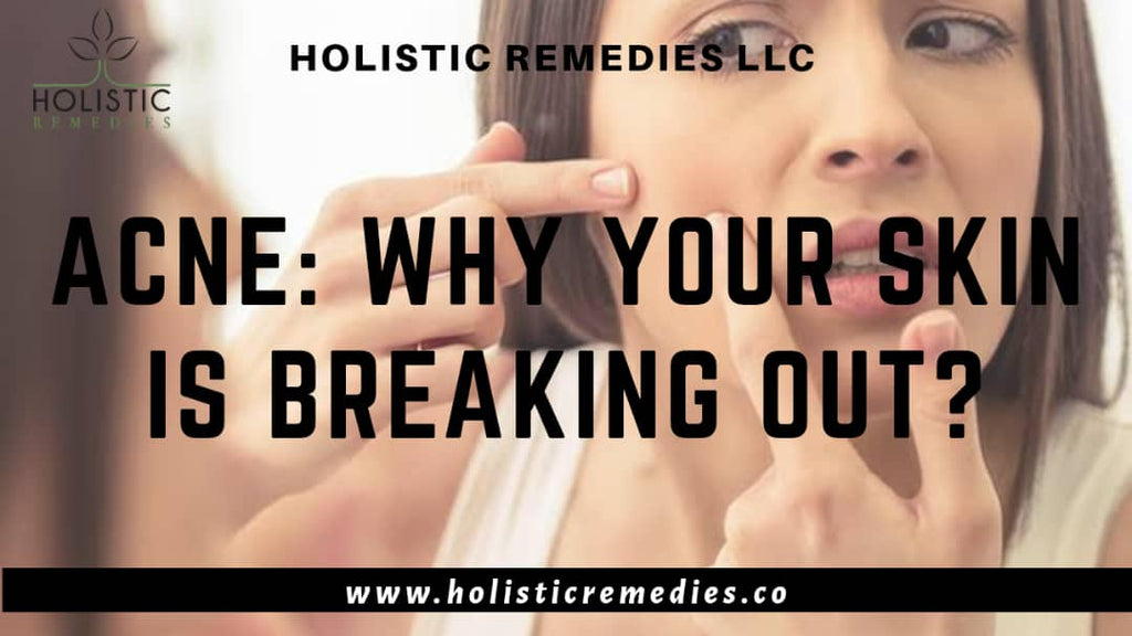 Acne: Why Your Skin is Breaking Out